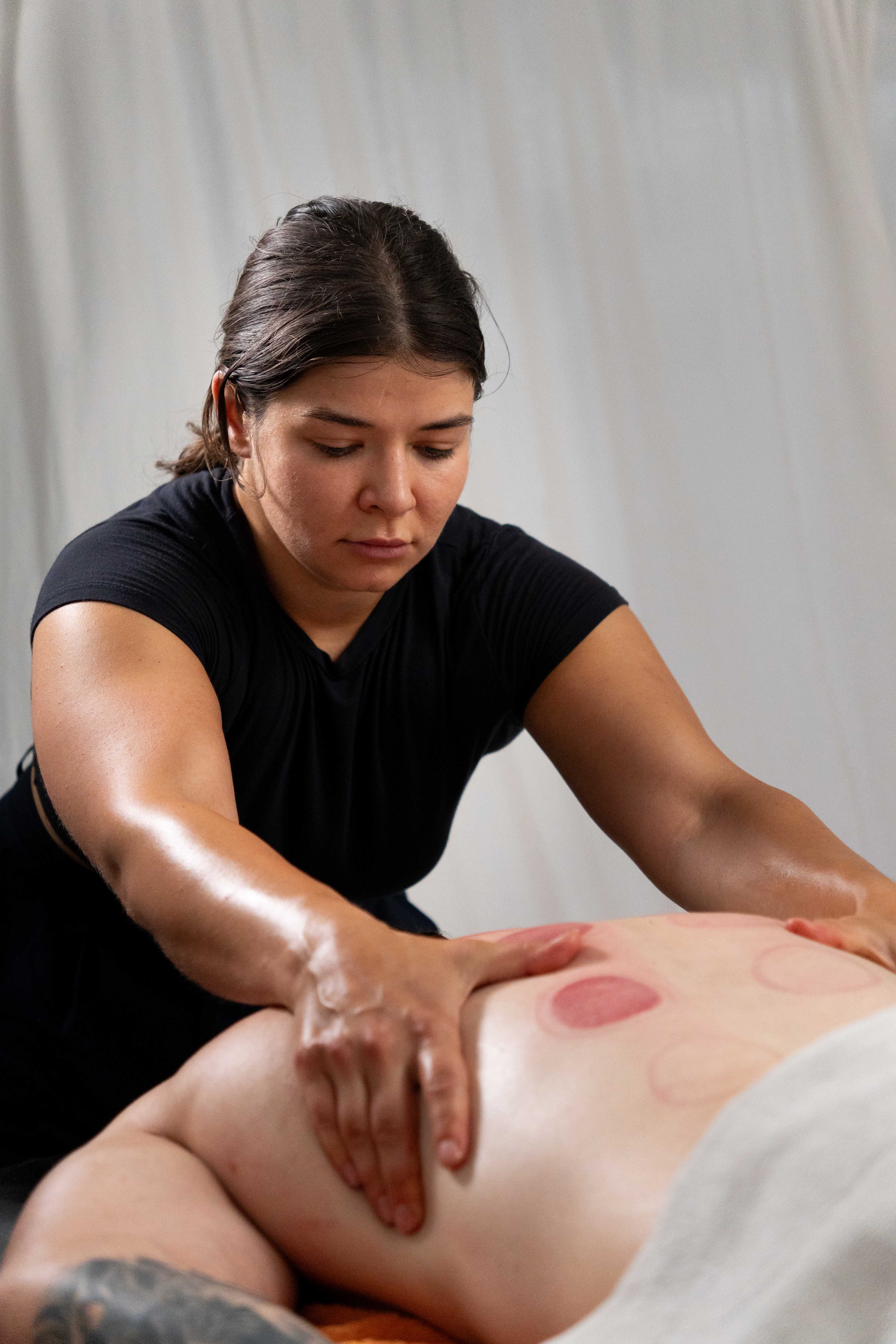 Cupping Therapy